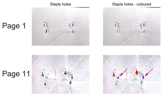 Staple Holes Examination, Forensically Examined